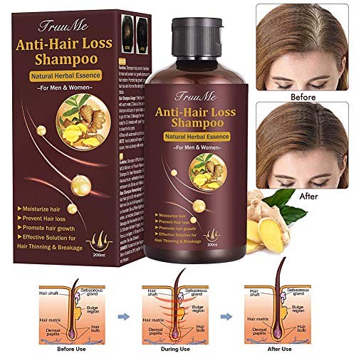 Hair Growth Shampoo, Hair Loss shampoo, Anti-Hair Loss Shampoo, Helps Stop Hair Loss, Grow Hair Fast, Hair Loss Treatment for Men & Women (220mL)