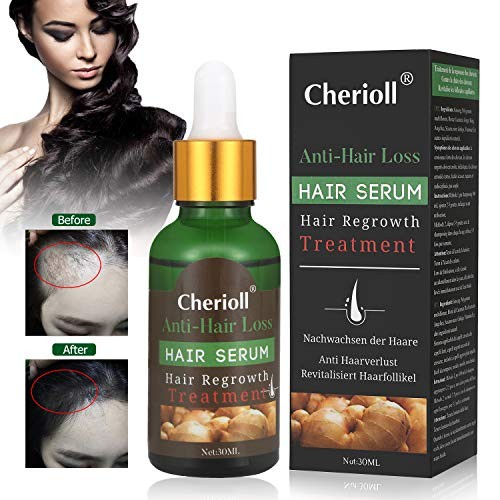 Hair Serum, Hair Treatment Serum Oil, Hair Loss &Hair Thinning Treatment, Hair Growth Oil for Stronger, Thicker, Longer Hair (30ml)